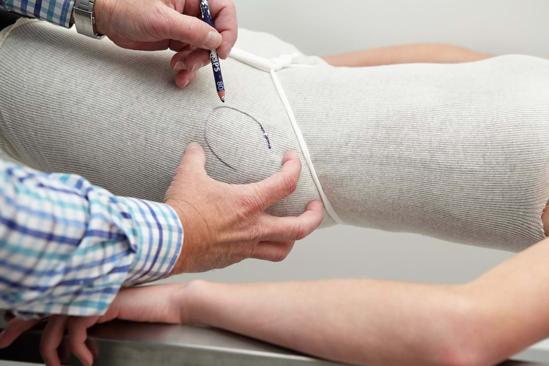 Anatomical landmarks are located