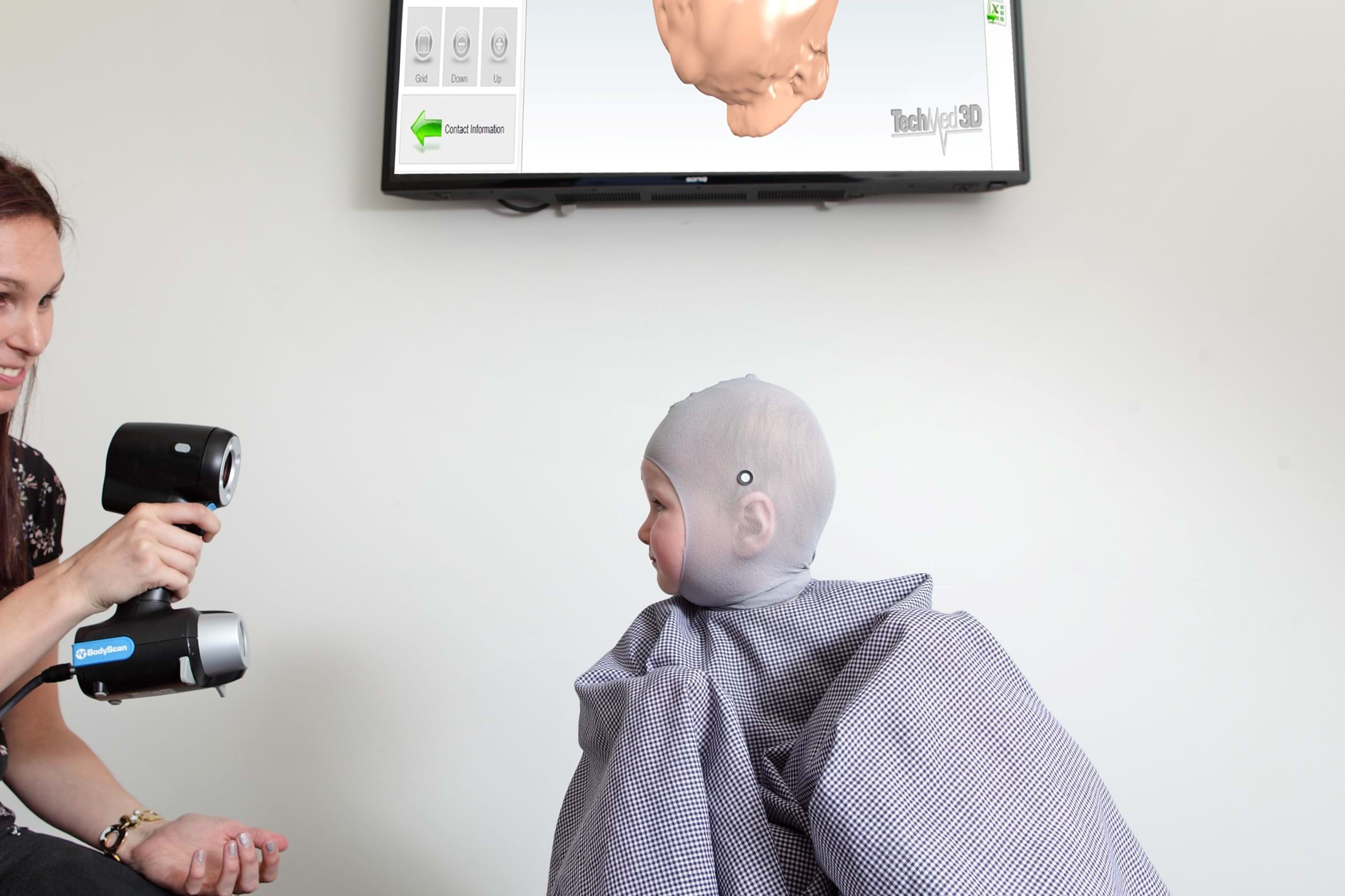 Are you concerned about your baby's head shape?