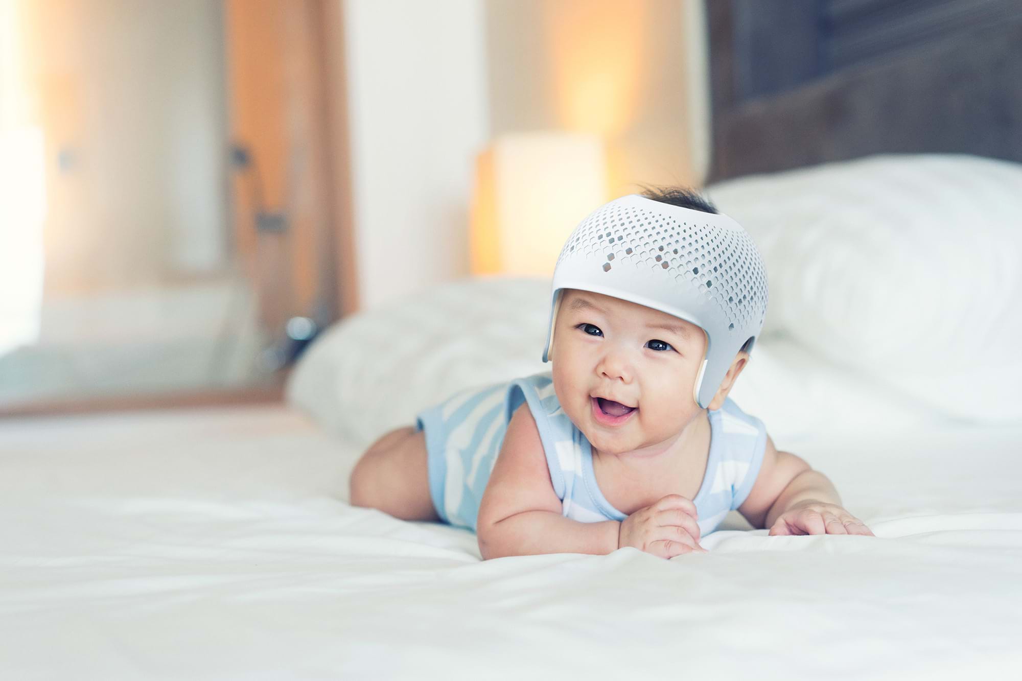 Serkel Plagiocephaly Helmet