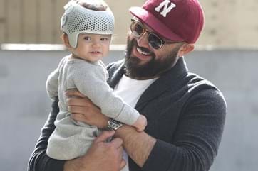 Plagiocephaly helmet